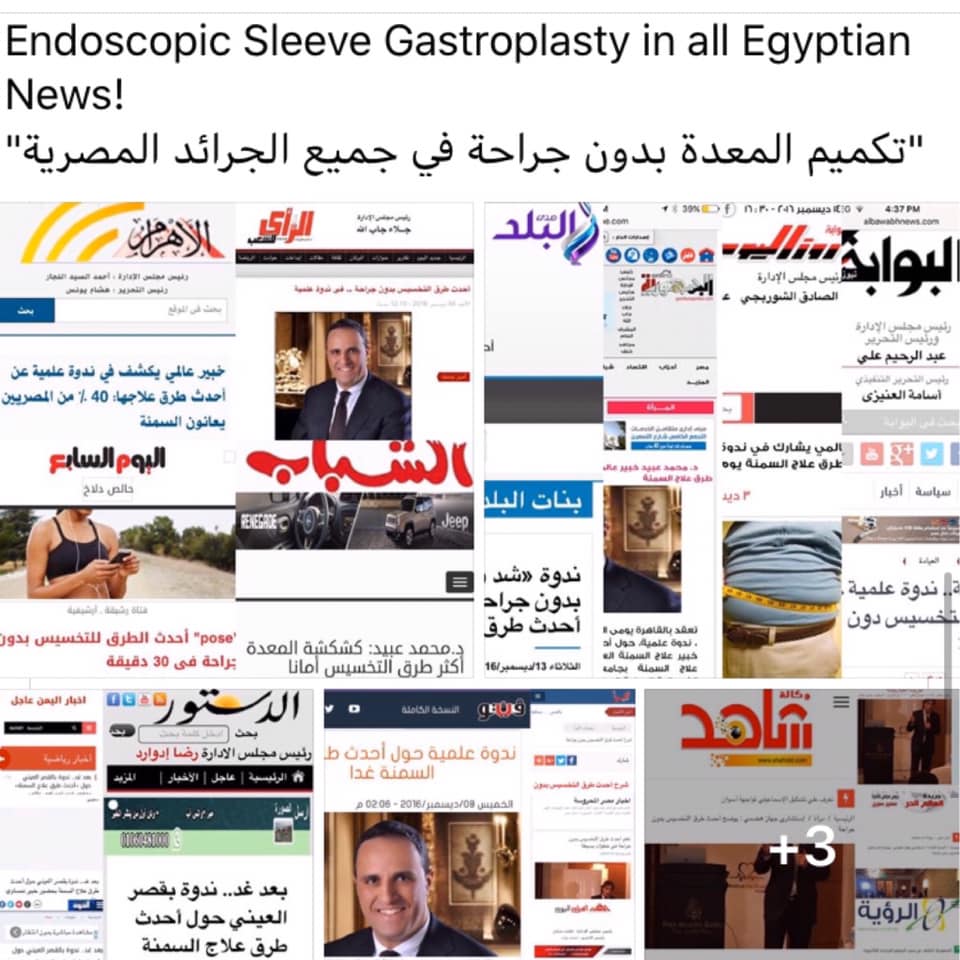 تكميم المعدة بدون جراحة في جميع الجرائد المصرية