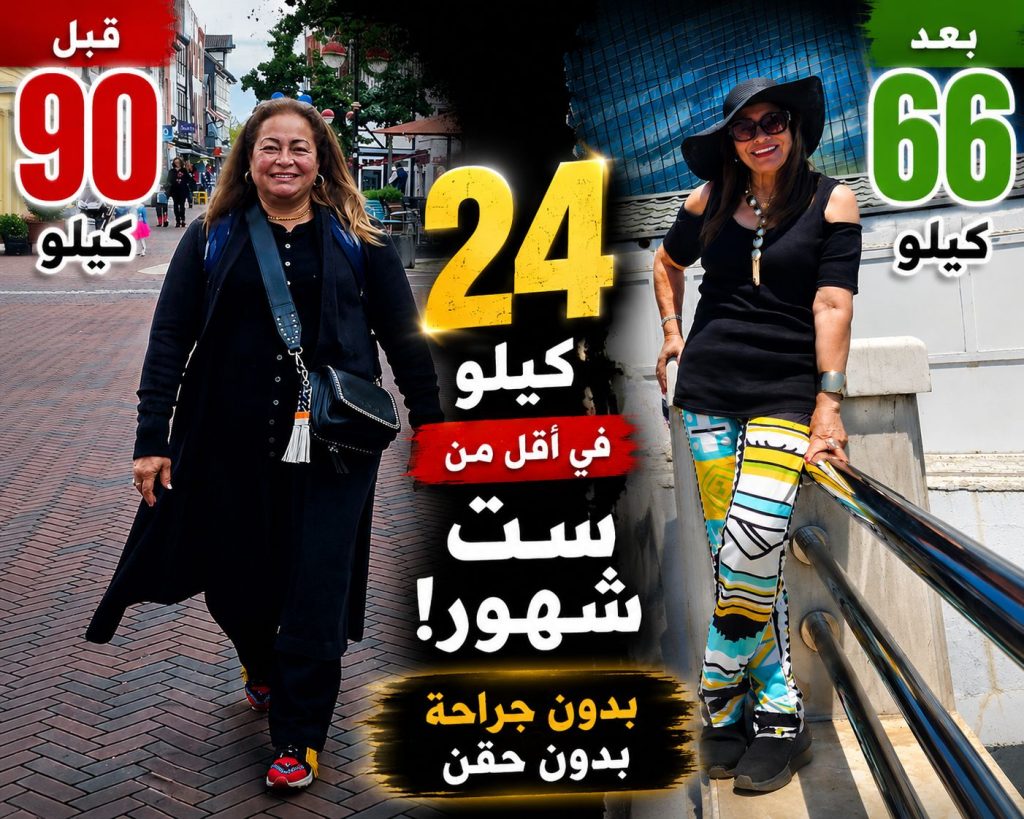 فقدان 24 كجم خلال أقل من 6 أشهر مع الحفاظ على المظهر الطبيعي للوجه والجسم